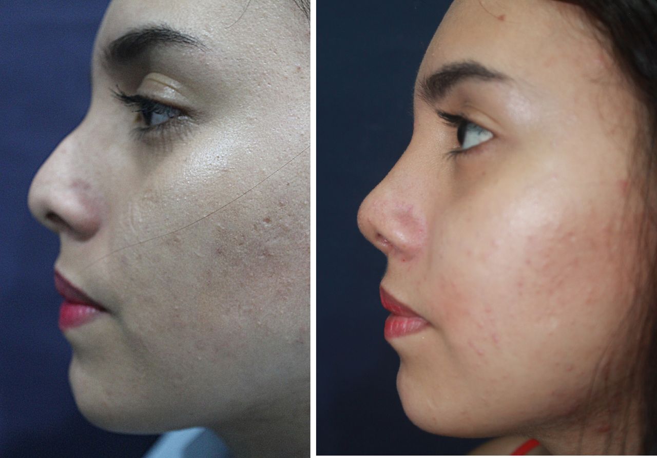 Jorge A Holguin Ruiz-35