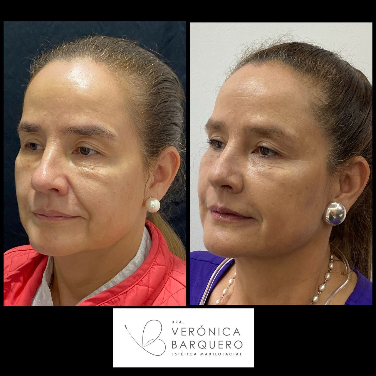 Veronica Maria Barquero Figueroa-23