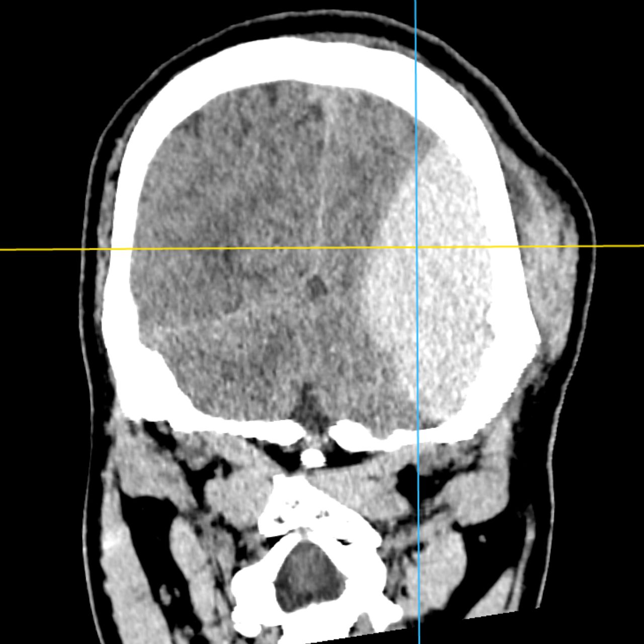 David Tafur Muñoz-1763