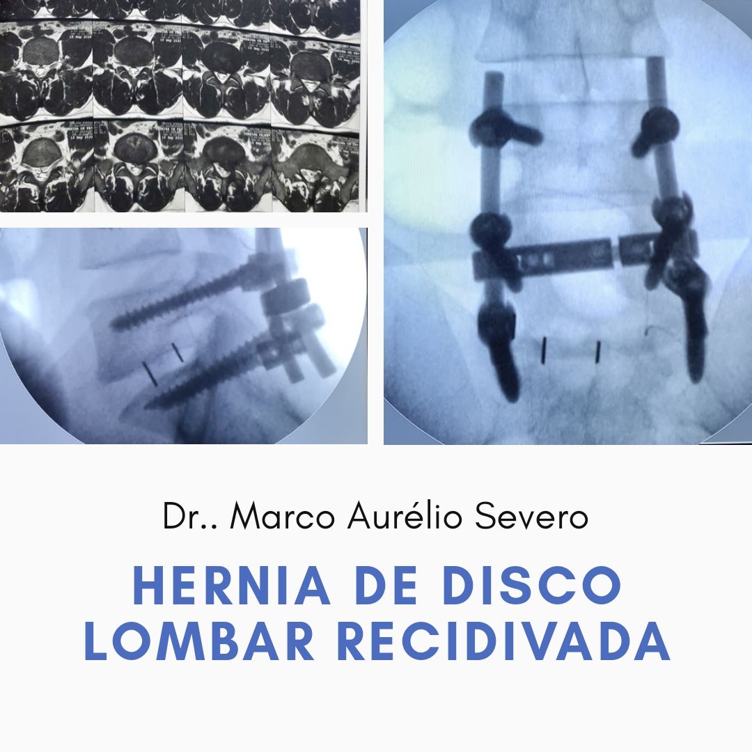 Marco Aurélio Severo Da Silva Versiani-51