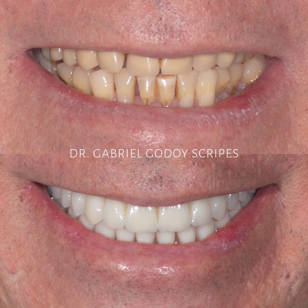 Gabriel Godoy Scripes-4