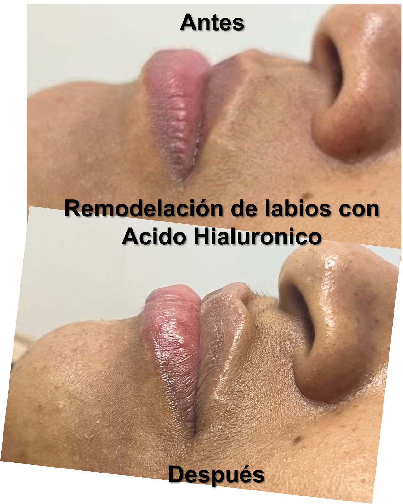 Victor Adolfo Benitez Campo-15