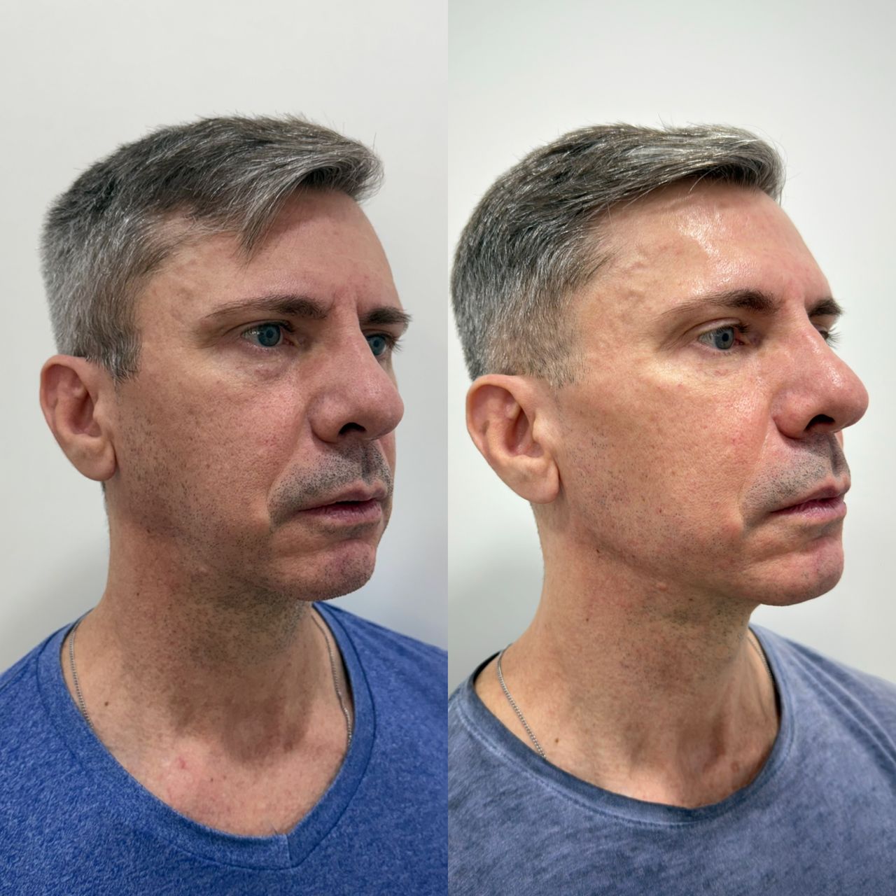 Caroline Benedeti-49