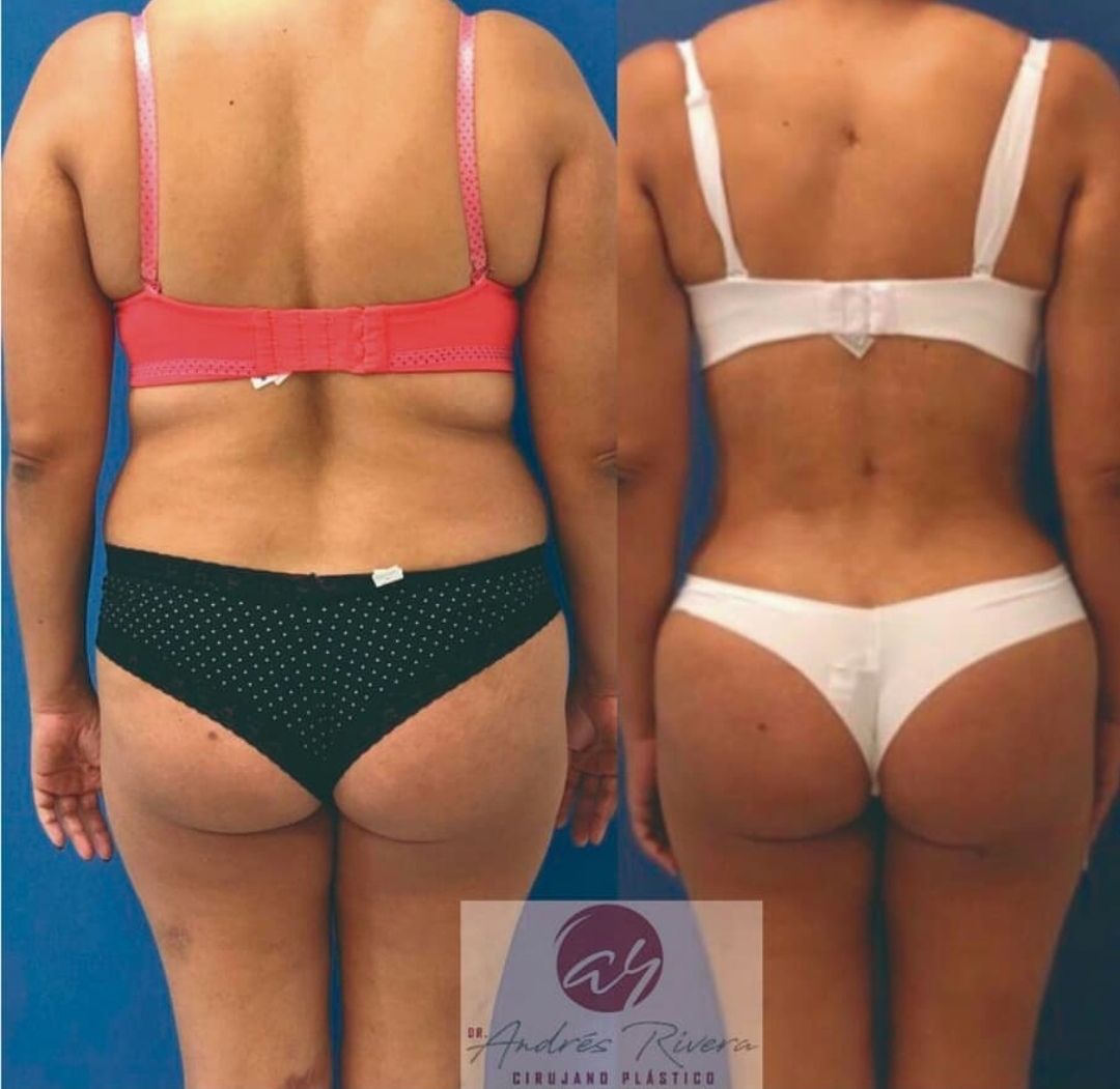 Andrés Rivera López-53