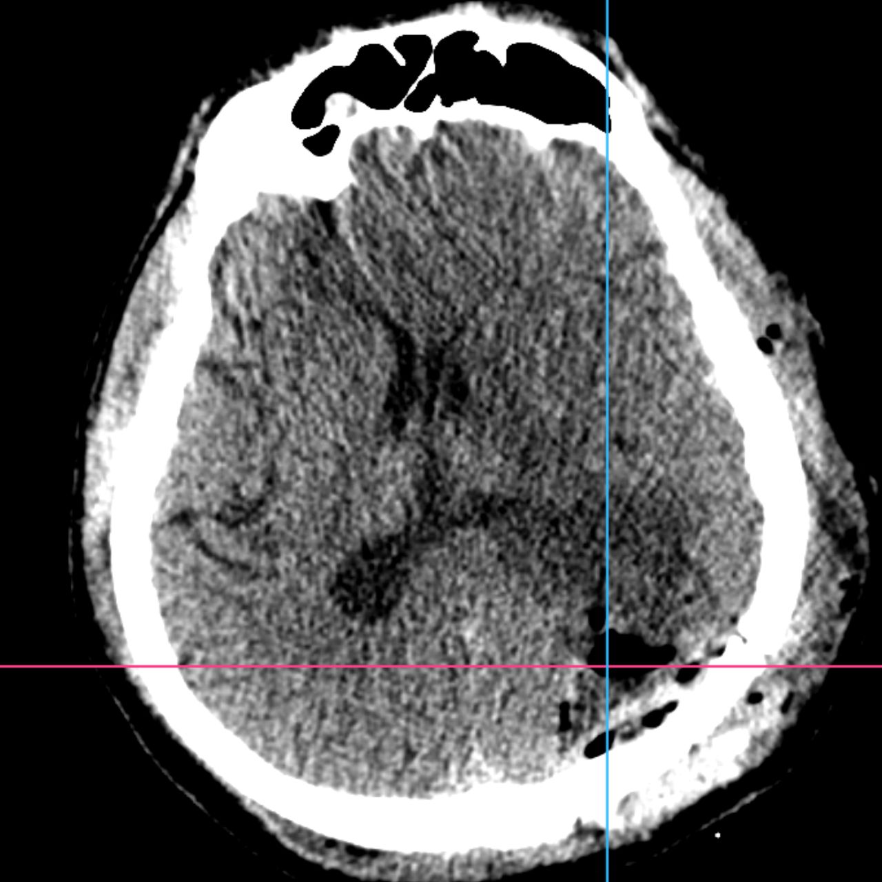 David Tafur Muñoz-1545