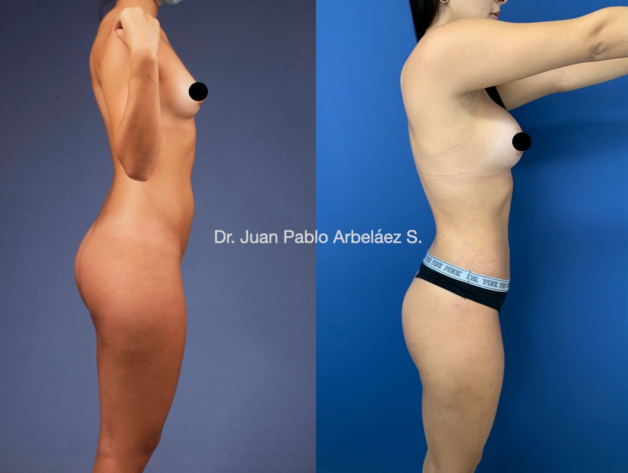 Juan Pablo Arbeláez Sierra-31