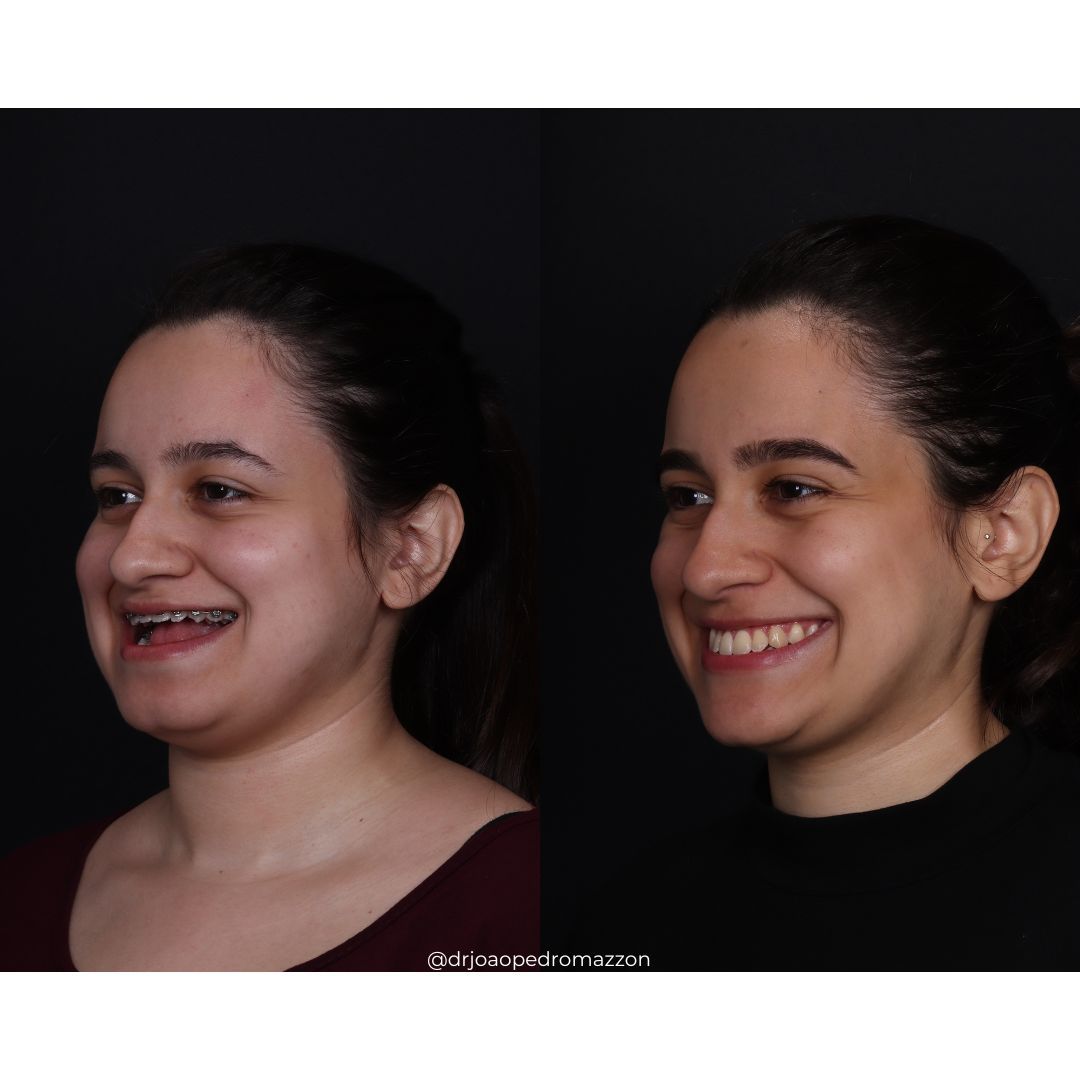 João Pedro Paulino Mazzon-67