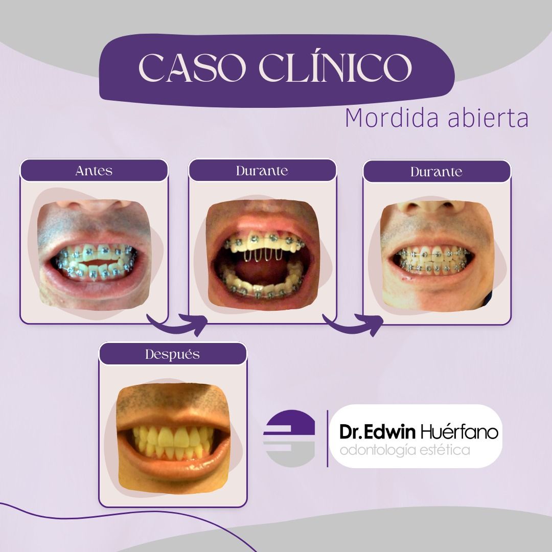 Edwin Javier Huerfano Mendoza-0