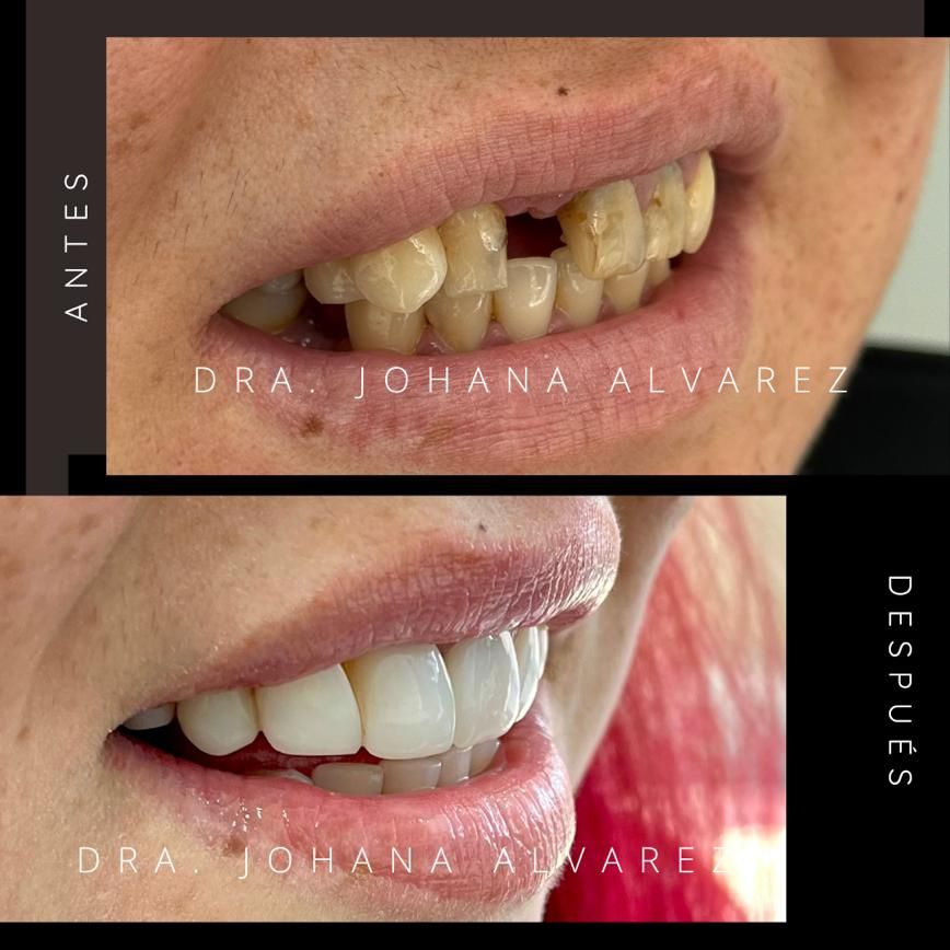 Johana Alvarez Castaño-0