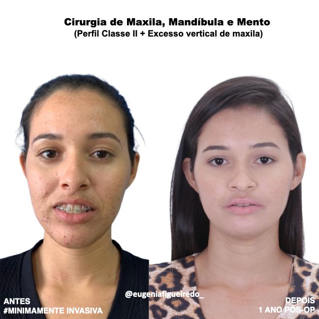 Eugênia Figueiredo-32