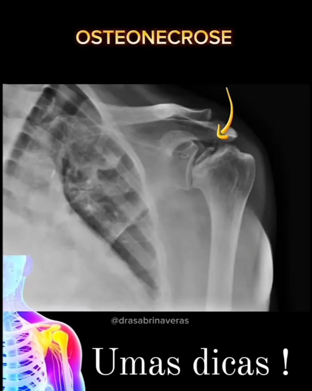 Orlando Turpo Mamani-3