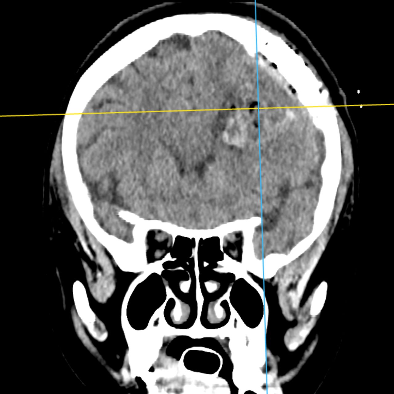David Tafur Muñoz-1929