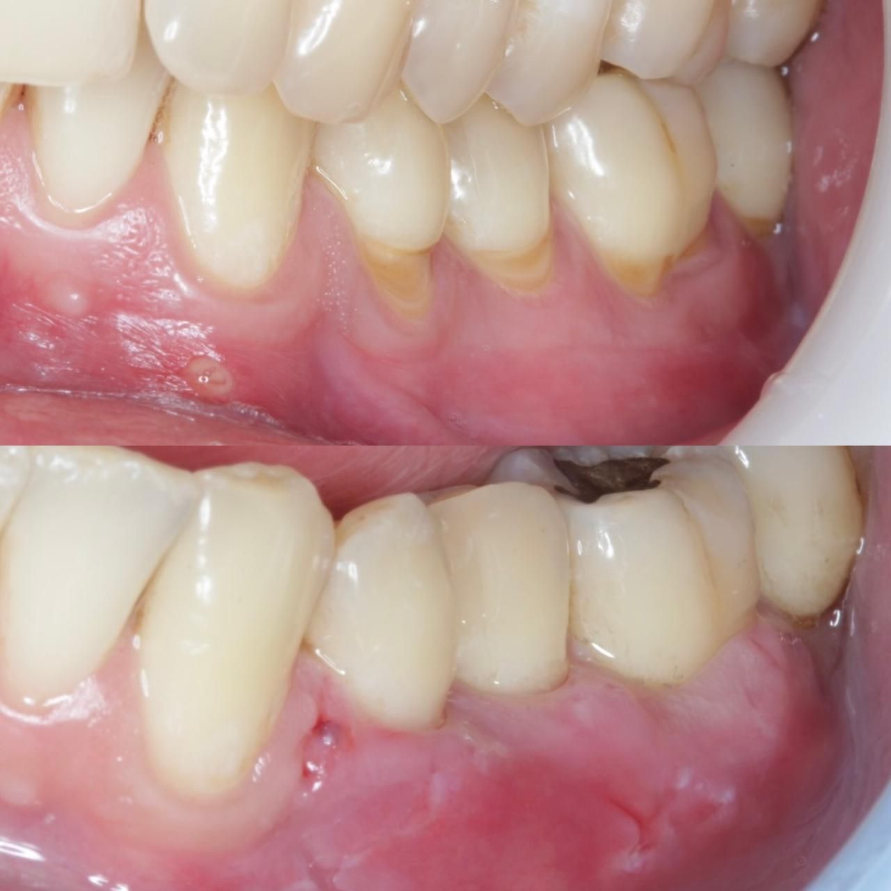 Antônio Alegria Do Nascimento-4