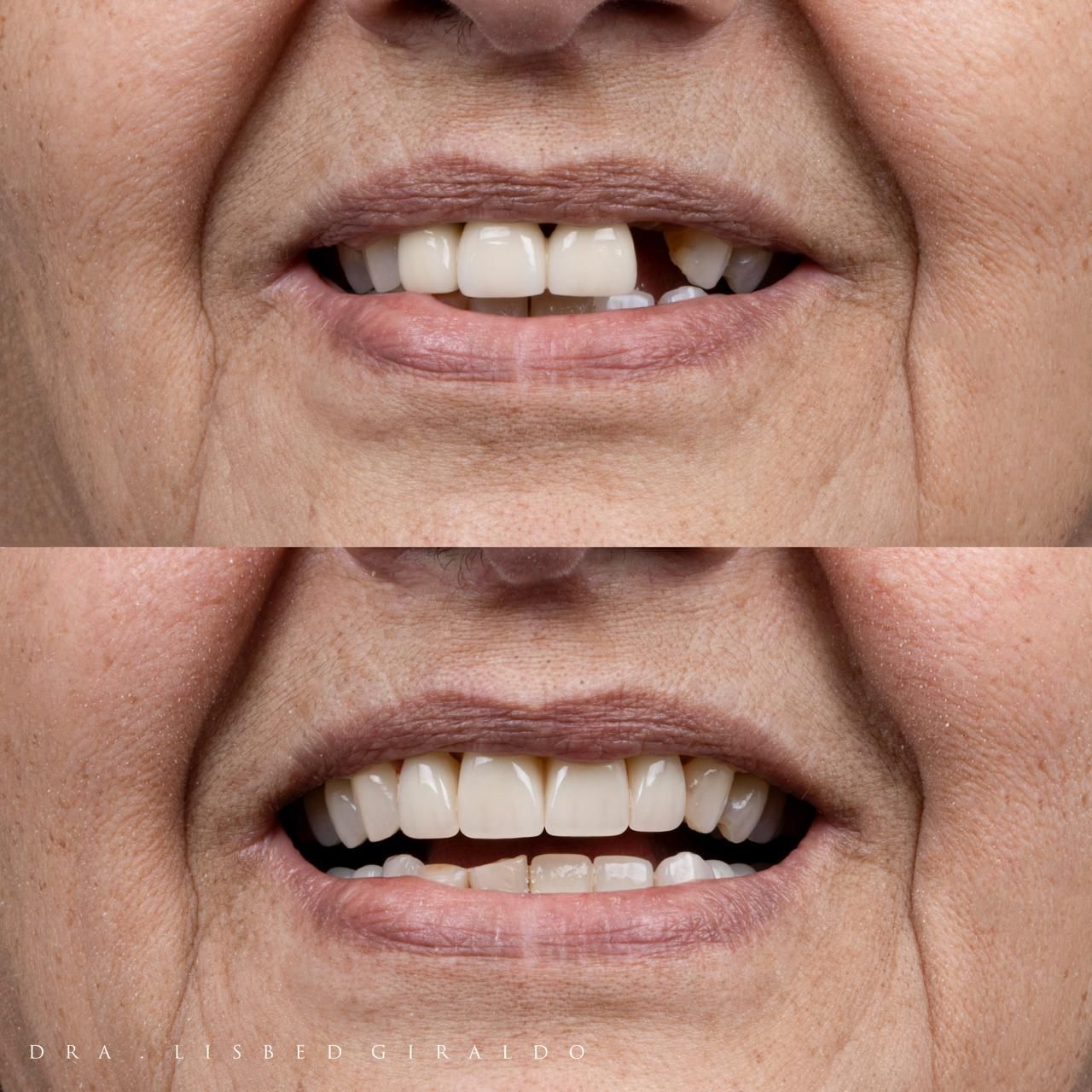 Lisbed Giraldo Olarte-36