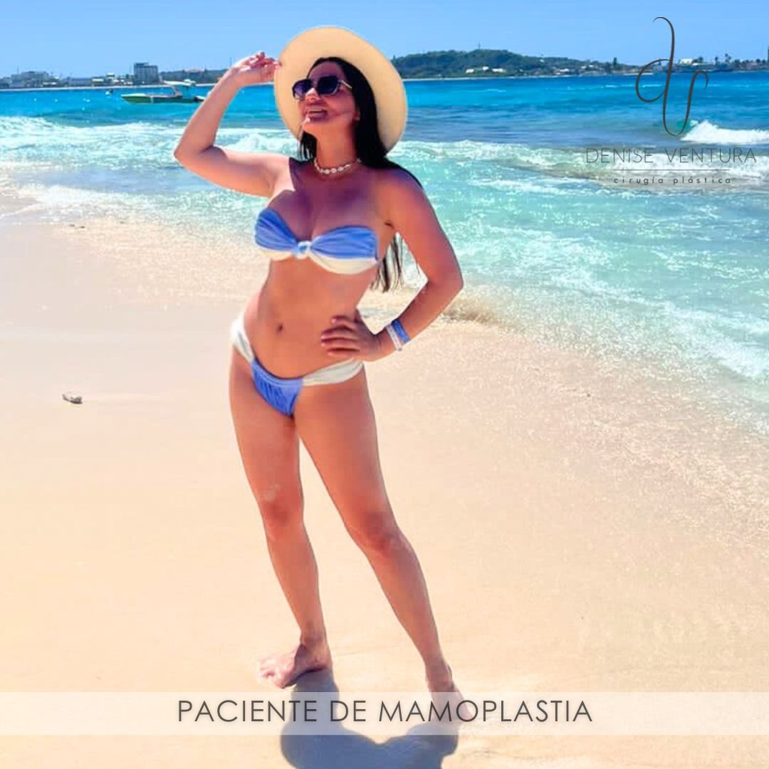 Denise Ventura Perez-6