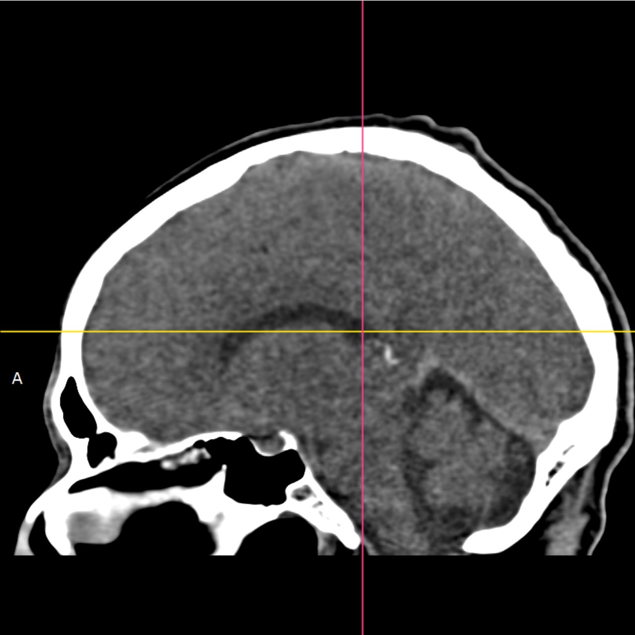 David Tafur Muñoz-2106
