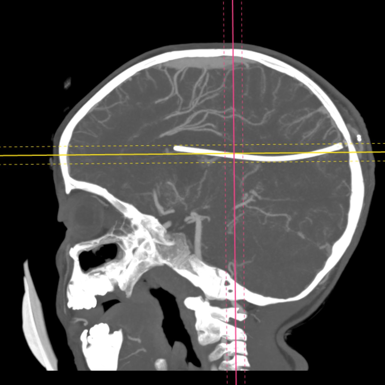 David Tafur Muñoz-1916