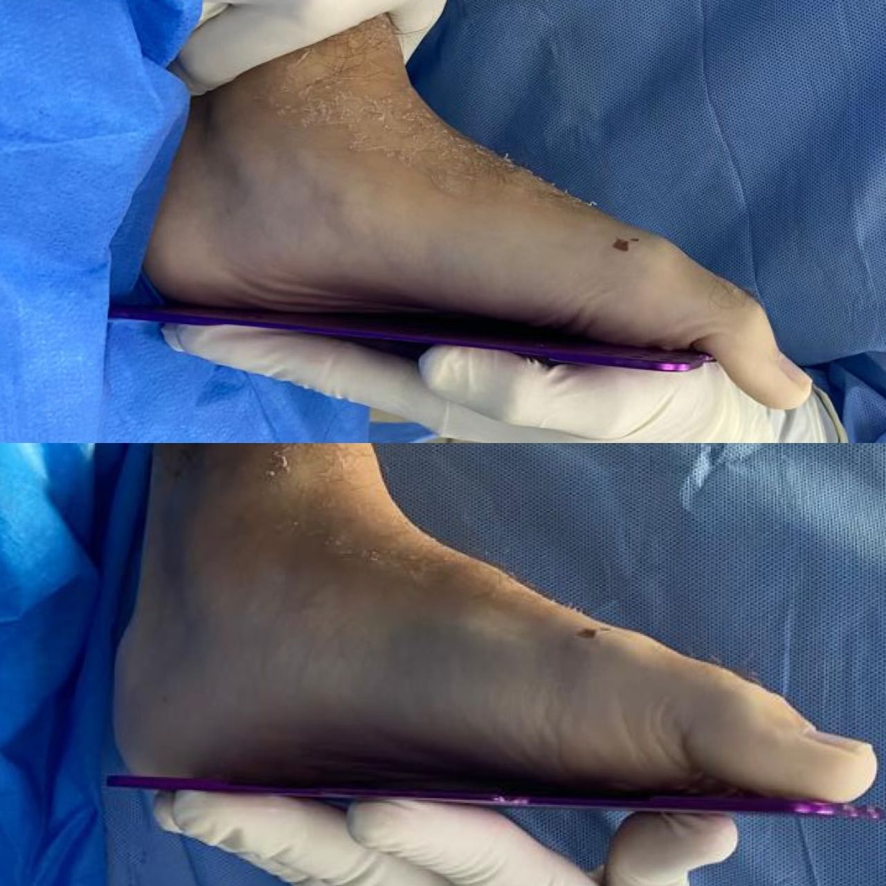 Leandro Jacomassi Machado-7