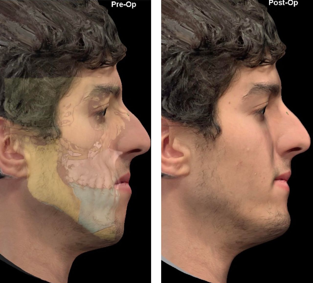 Daniel Assunção-22