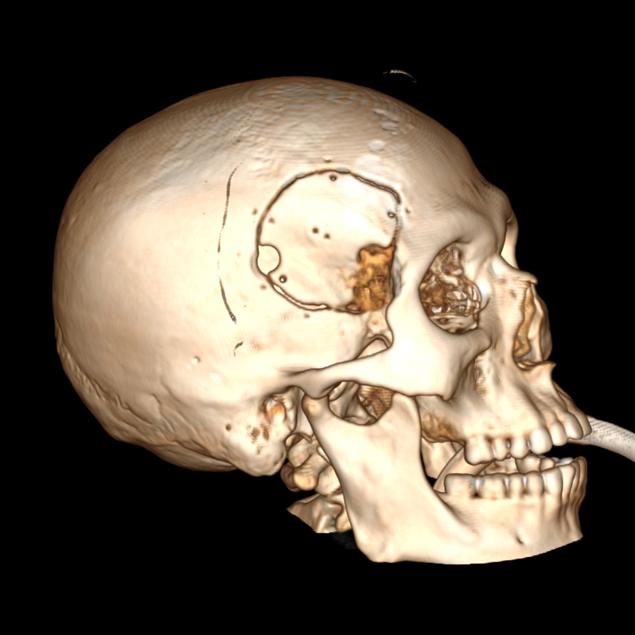 David Tafur Muñoz-1212