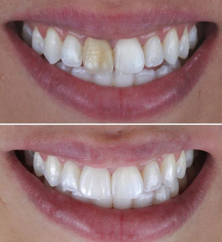 Daniel De Souza Pereira-72