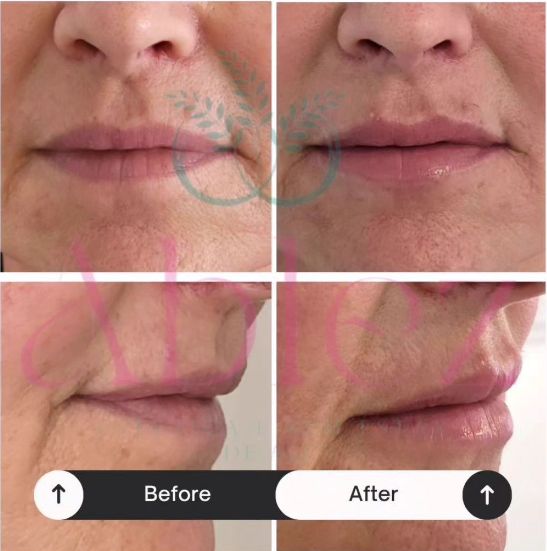 Ana Paula Andreolla-0