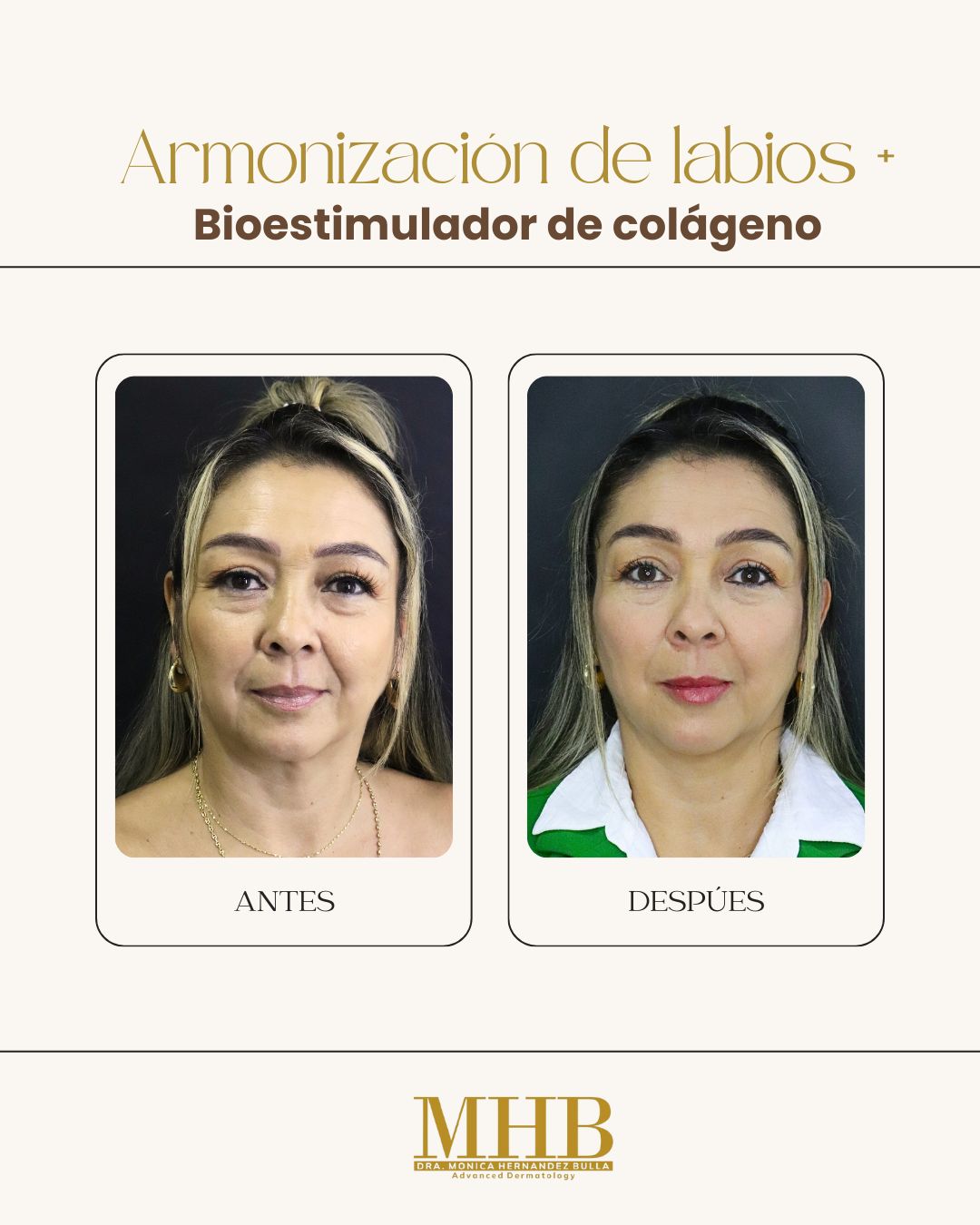 Mónica Hernandez Bulla-40