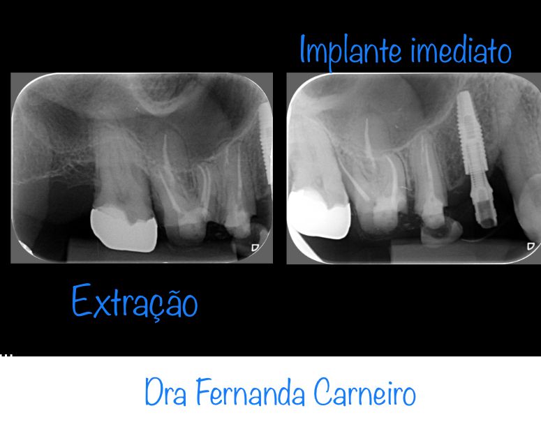 Fernanda Carneiro Pinto-26