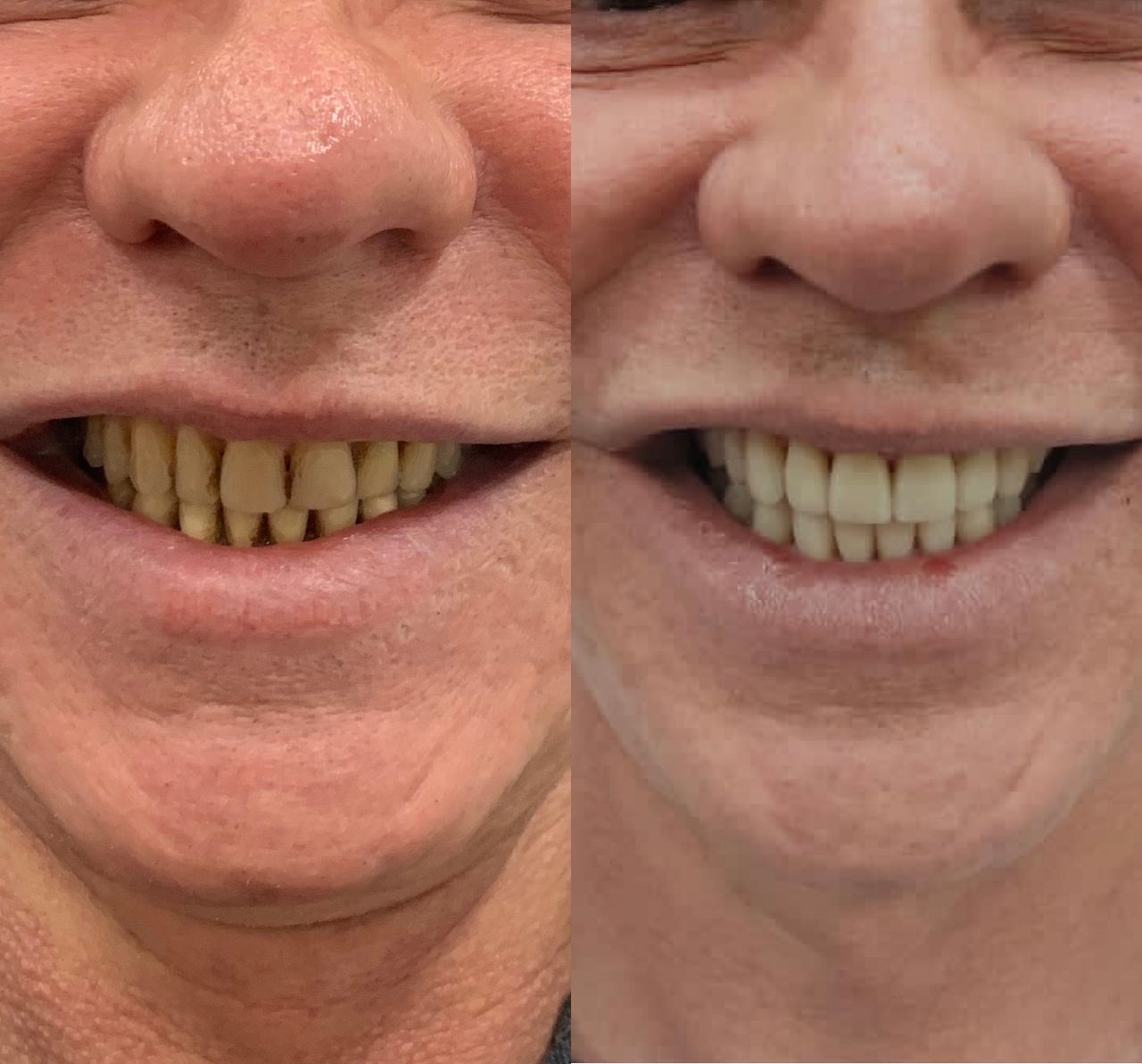 Nayara Fraga De Miranda-14