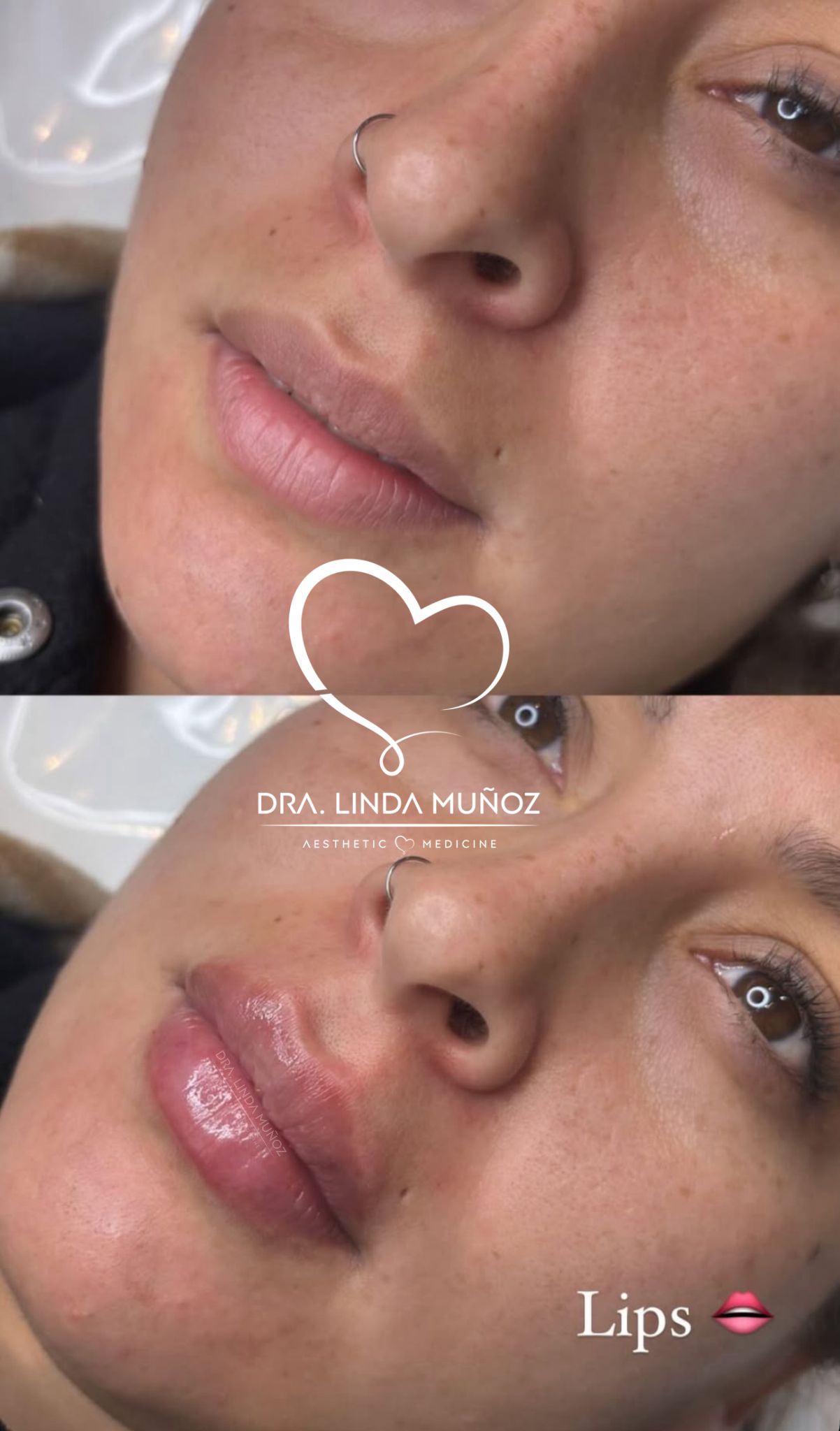 Linda Muñoz-54