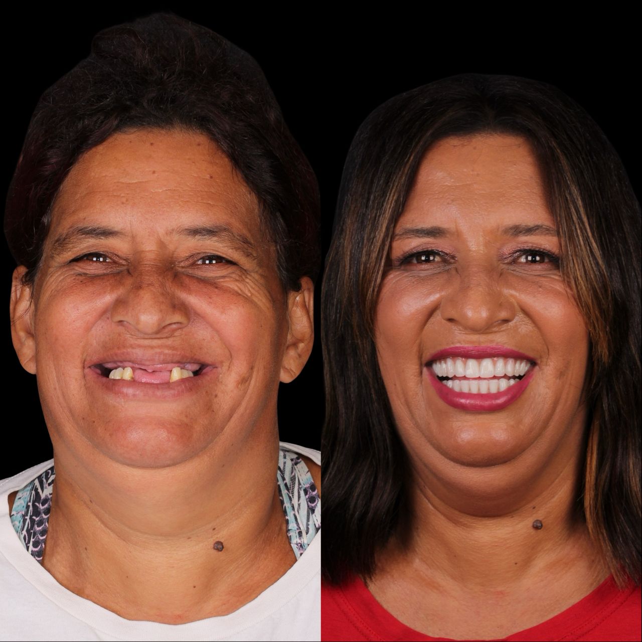 Caroline Benedeti-37