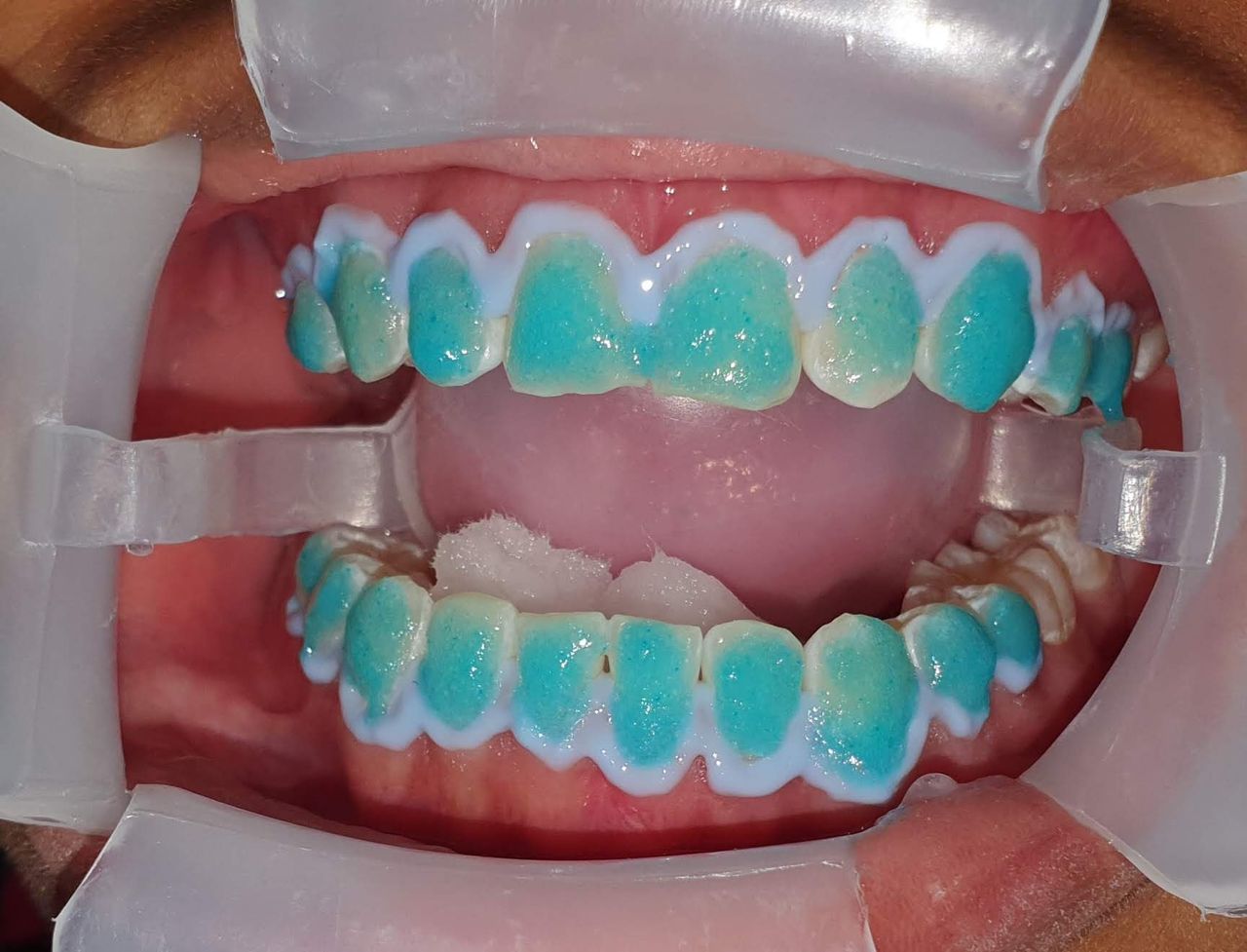 Felix Antonio Serpa Mendoza-4