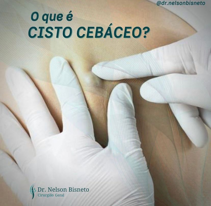 Nelson Bisneto-41
