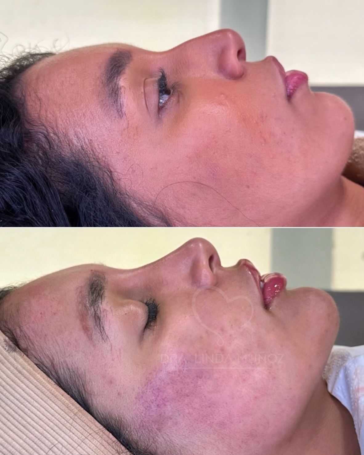 Linda Muñoz-10