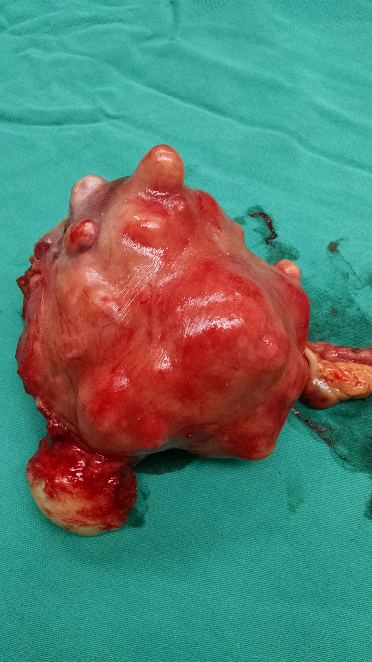 Carla  Lozada Lozada-16