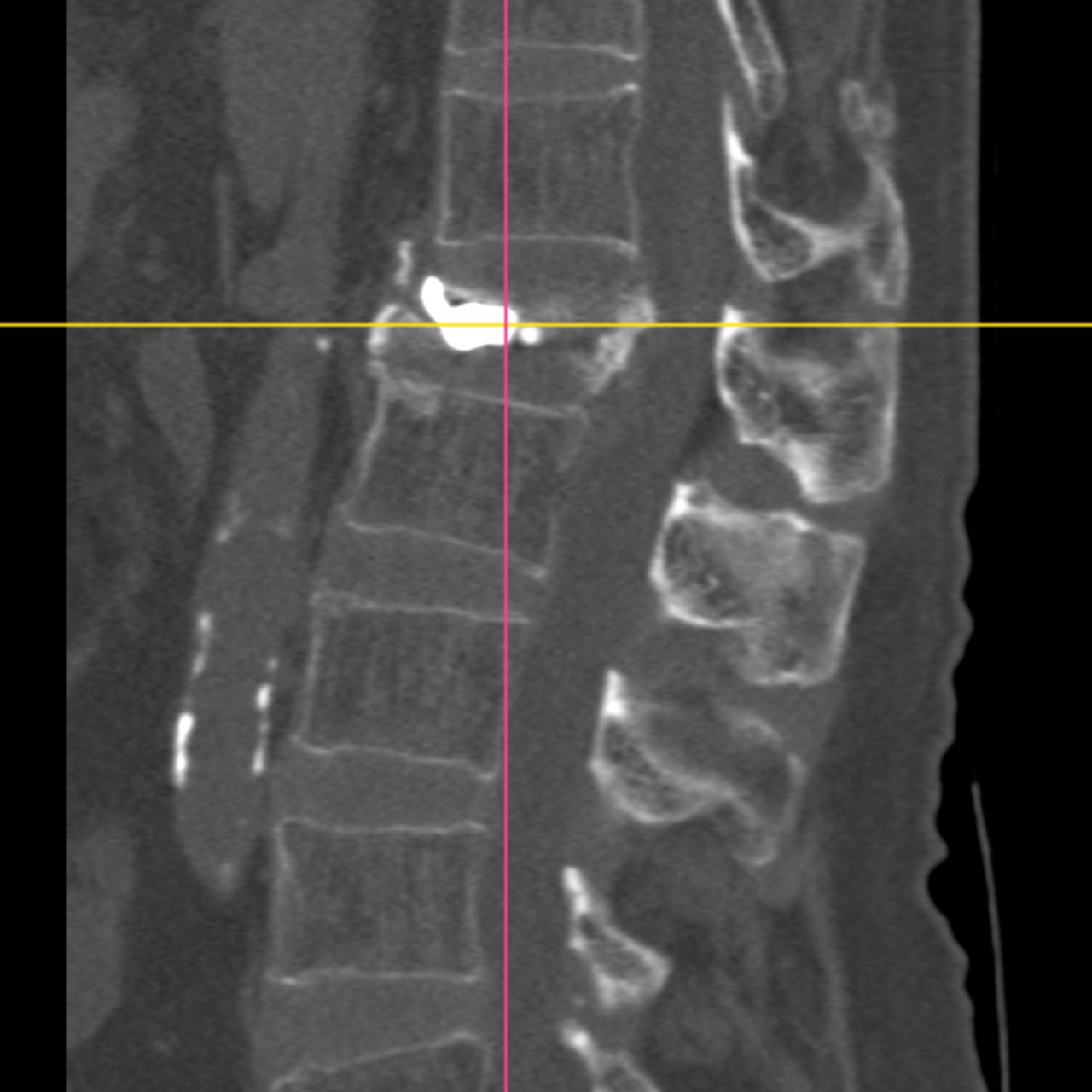 David Tafur Muñoz-1718