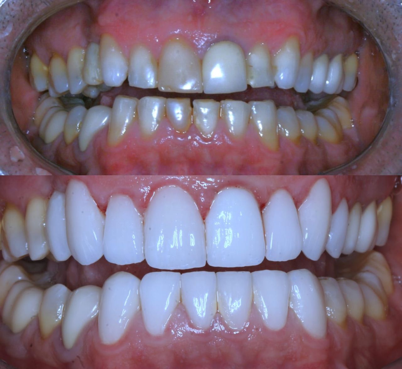 Neander Guitarrare Peraro-0