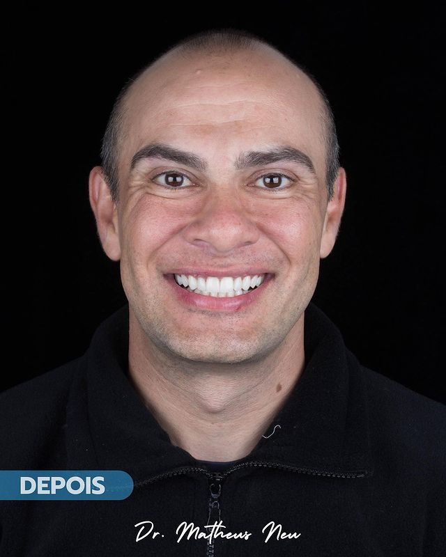 Matheus Da Silveira Neu-7