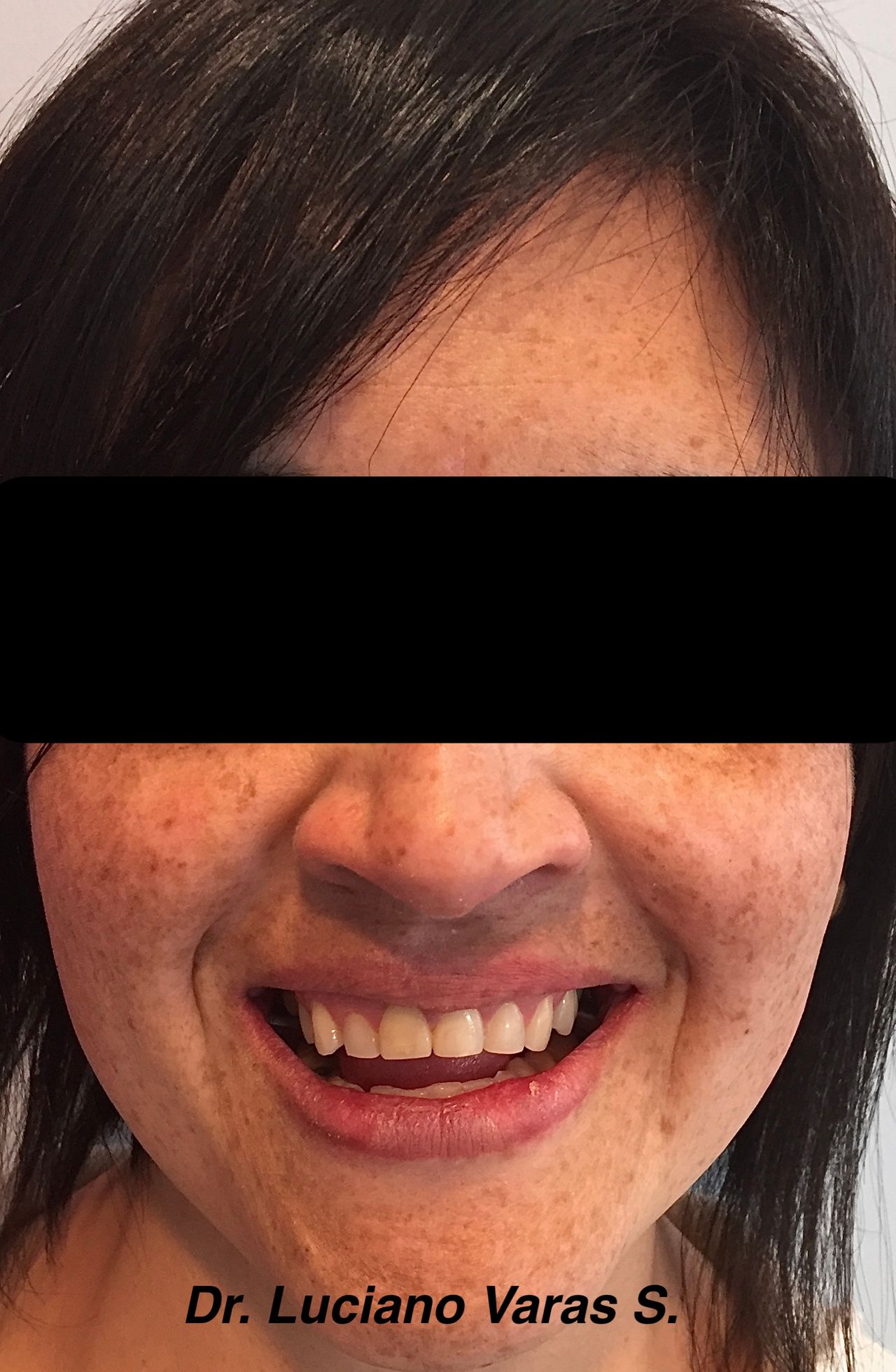 Luciano Varas Salinas-12