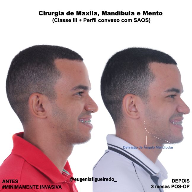 Eugênia Figueiredo-26