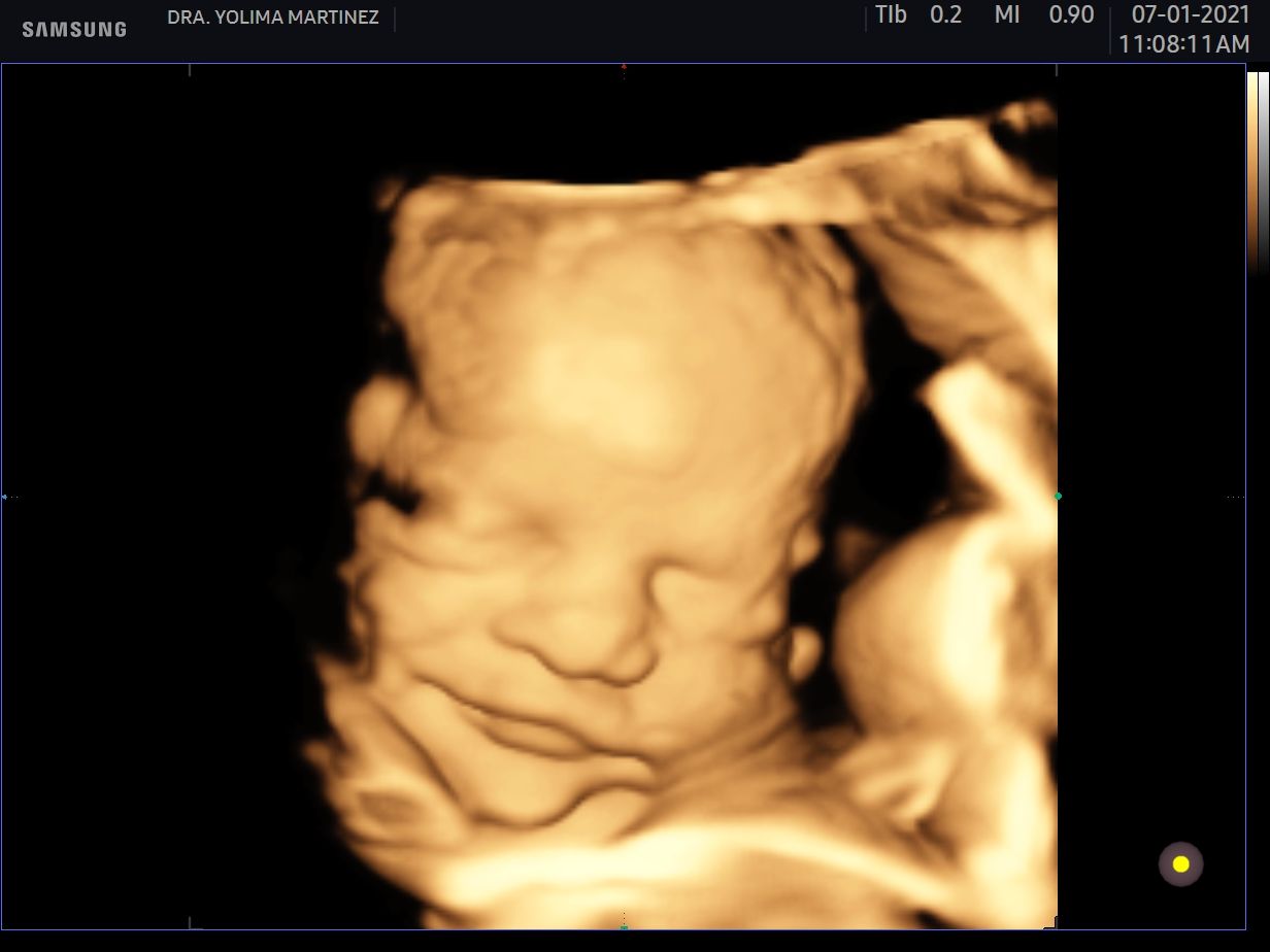 Mercy Yolima Martínez Velásquez-9