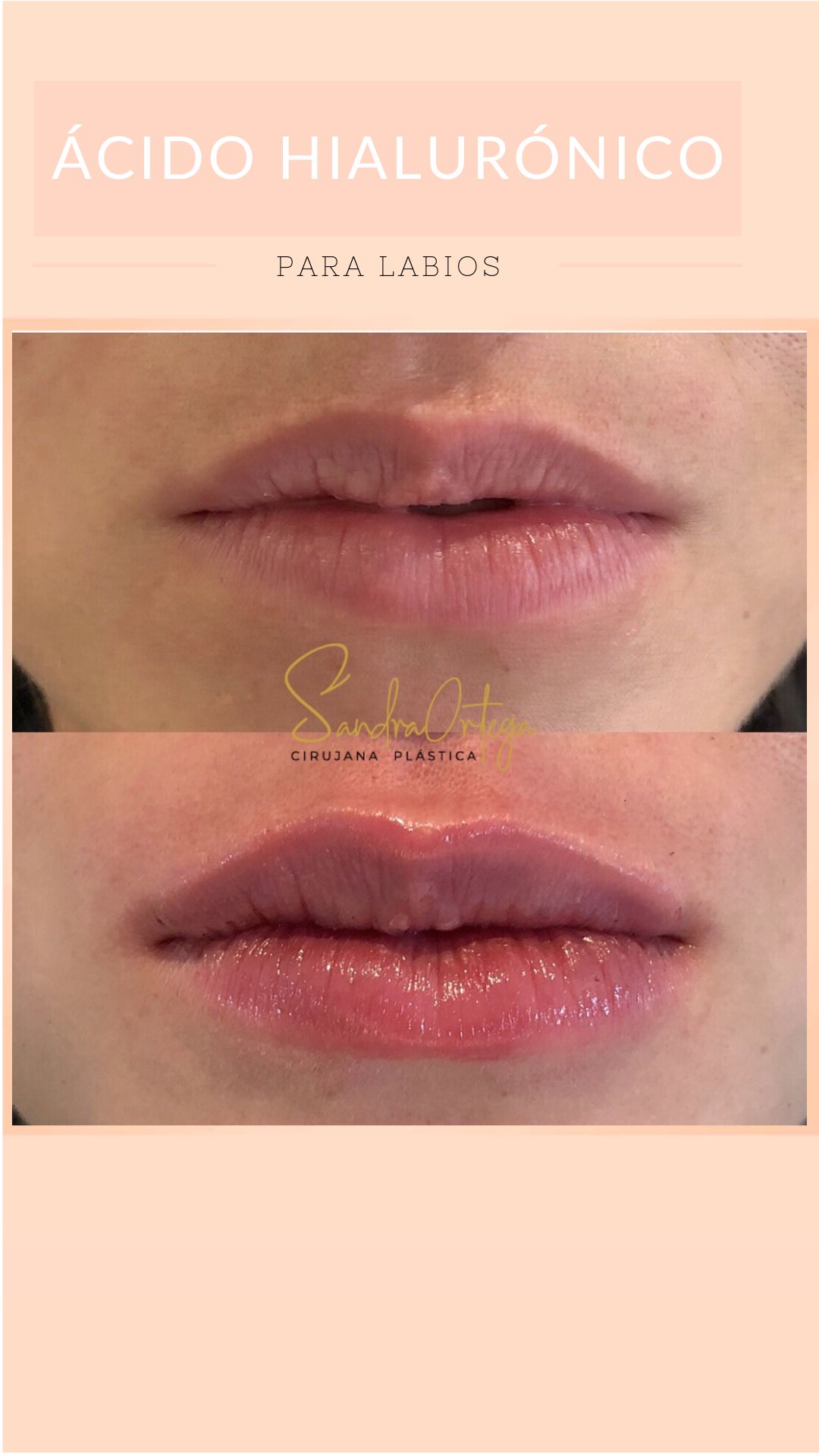 Sandra Viviana Ortega Trejos-37