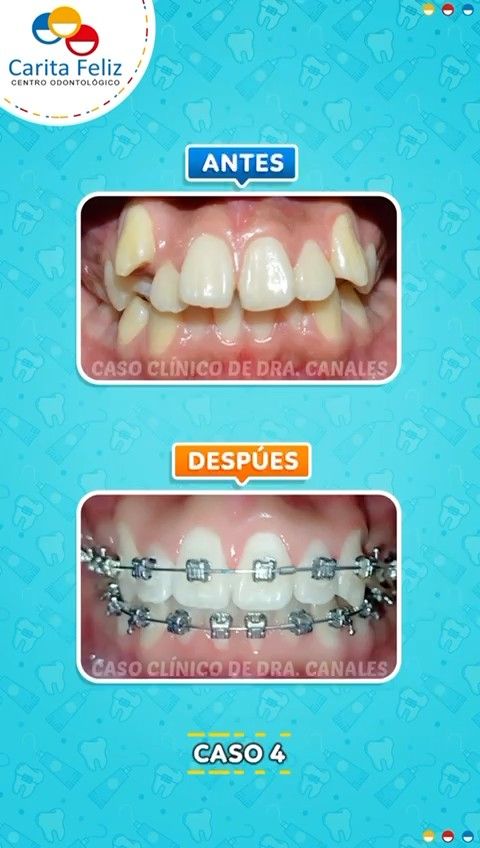 Angela Canales Larrea-7