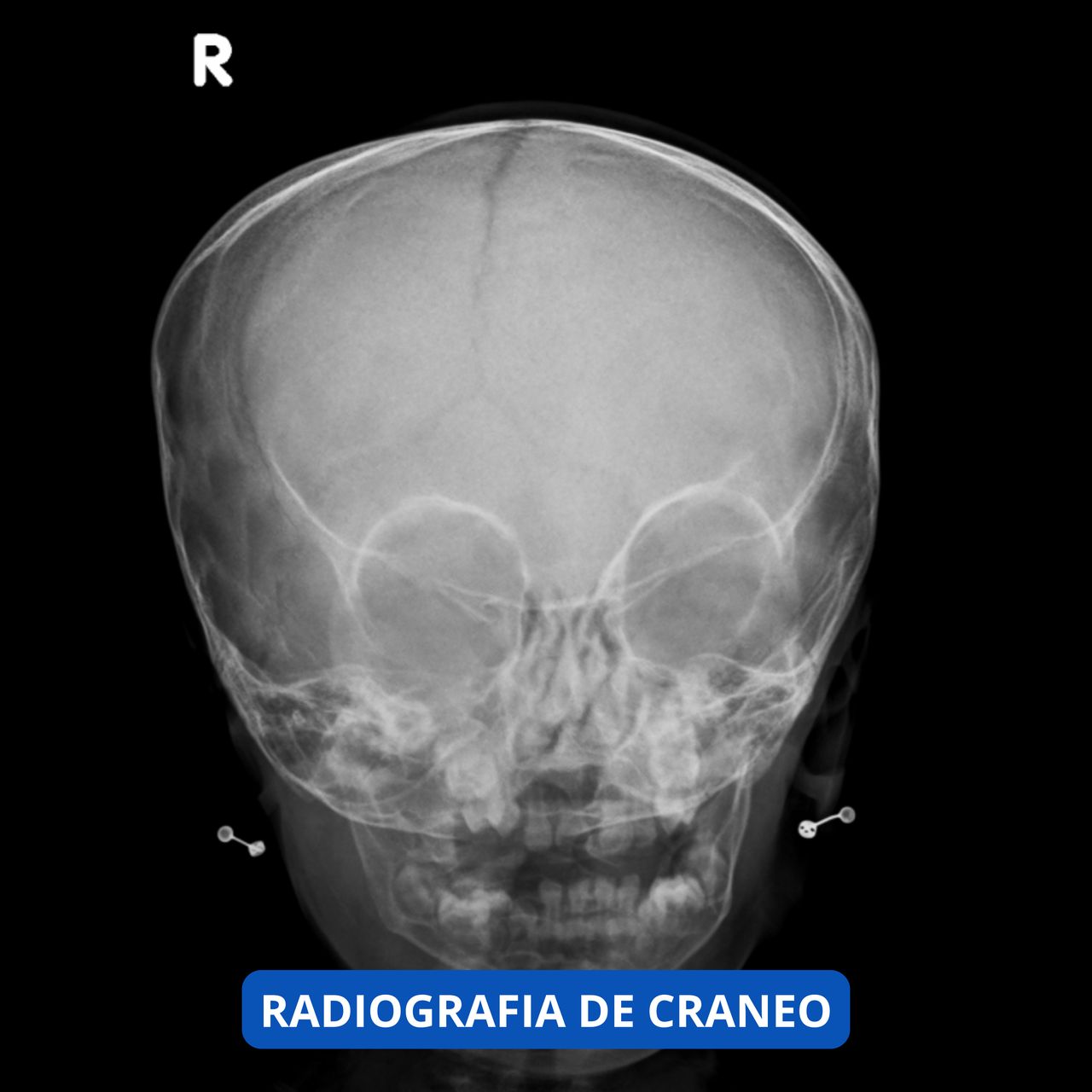 David Tafur Muñoz-1112