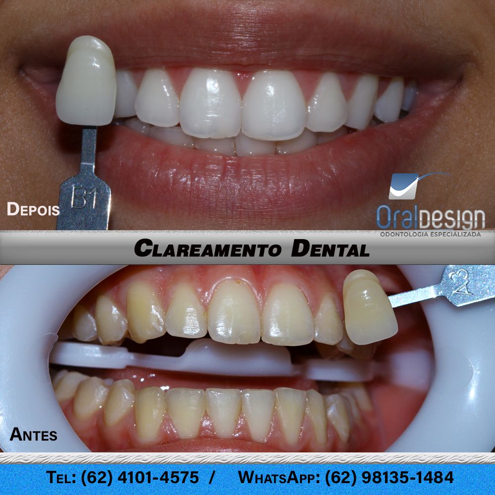 Danilo Monteiro Rezende Pereira-14