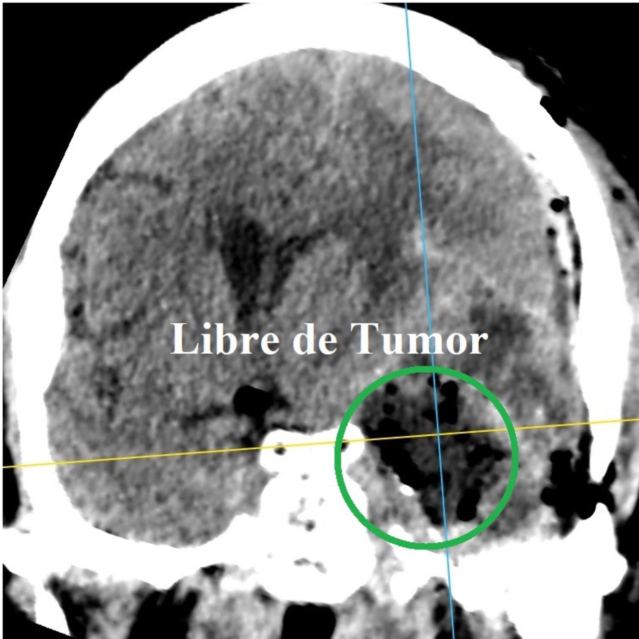 David Tafur Muñoz-1361