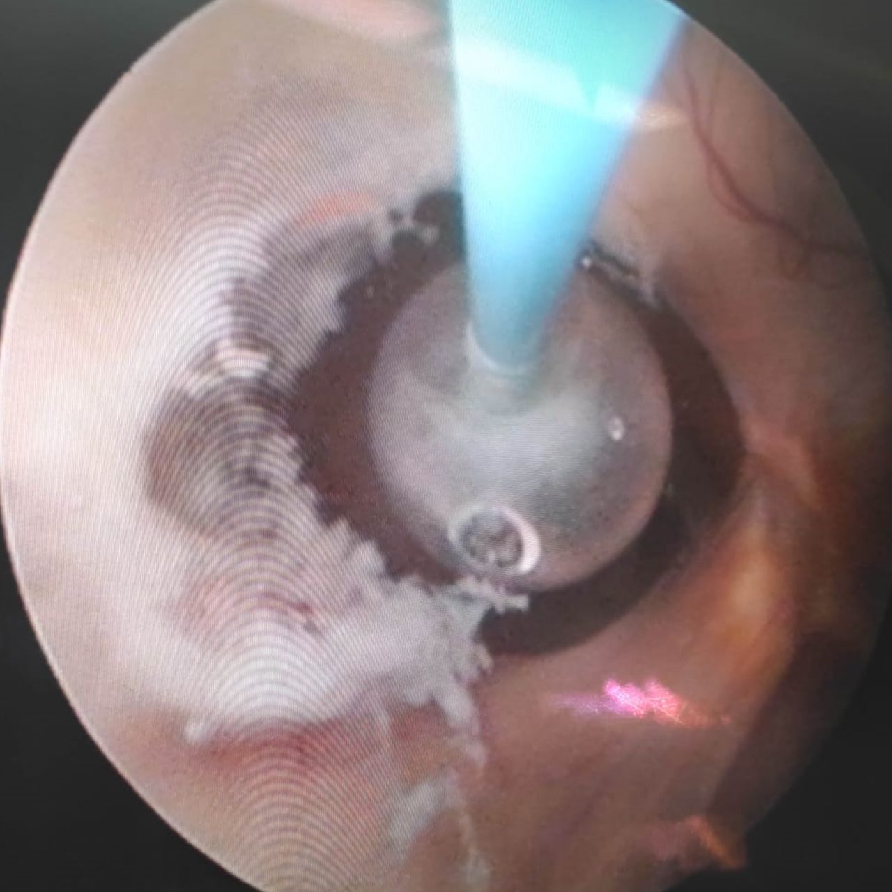 David Tafur Muñoz-1203