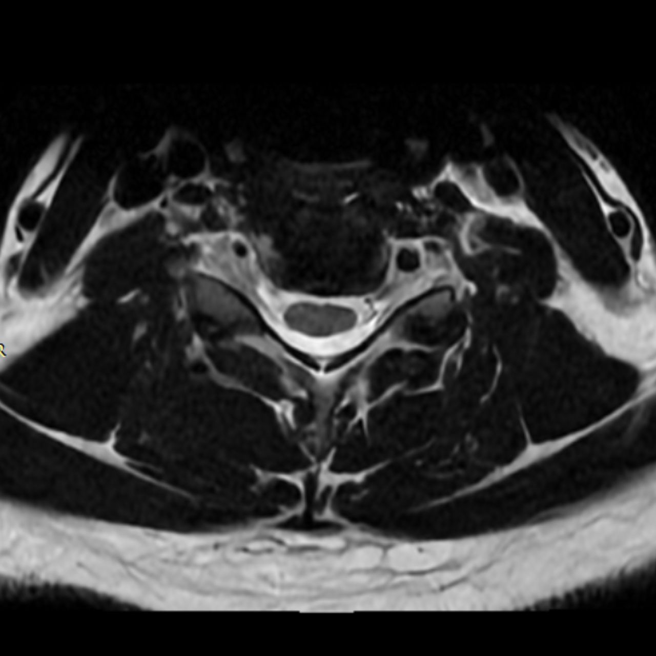 David Tafur Muñoz-1823