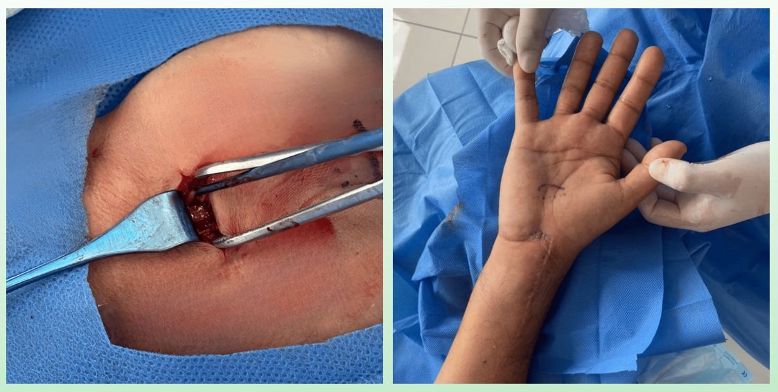 David Tafur Muñoz-2165