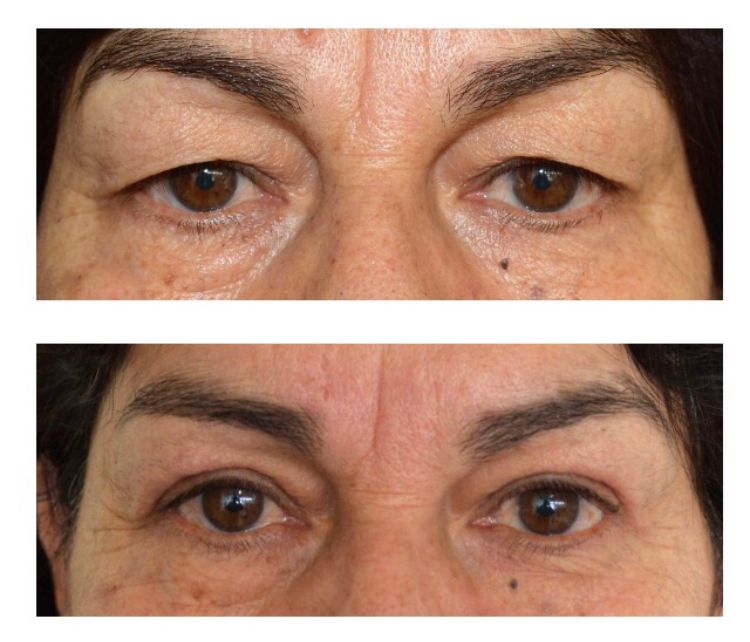 Sebastián Zapata Orellana-0